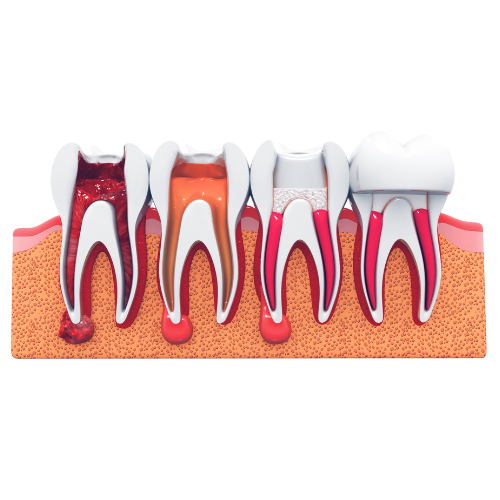 https://dentalclub-clinic.com/wp-content/uploads/2025/03/ขนาด-578800-px-3.png