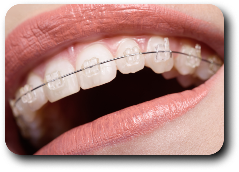 https://dentalclub-clinic.com/wp-content/uploads/2025/08/5-3.png