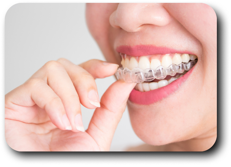 https://dentalclub-clinic.com/wp-content/uploads/2025/08/6-2.png