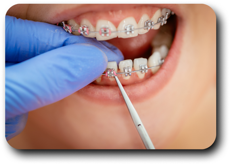 https://dentalclub-clinic.com/wp-content/uploads/2025/08/7-1.png