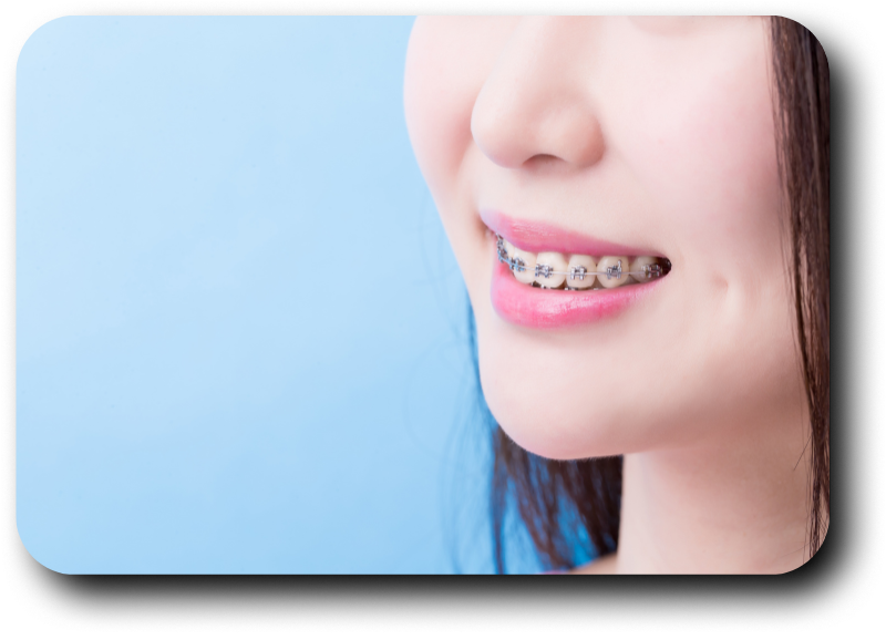 https://dentalclub-clinic.com/wp-content/uploads/2025/08/8-2.png
